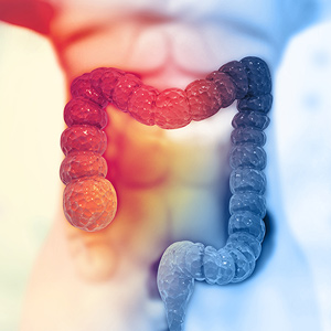 Predicting Colorectal Cancer Recurrence